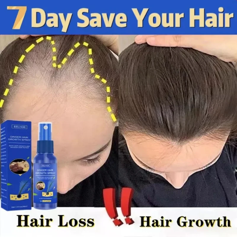 Hair Growth Spray Promote Fast - đánh giá và giá Perfume Zara