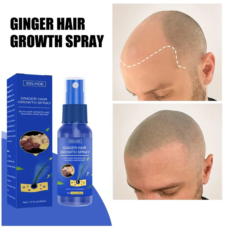 Hair Growth Spray Promote Fast - đánh giá và giá Perfume Zara