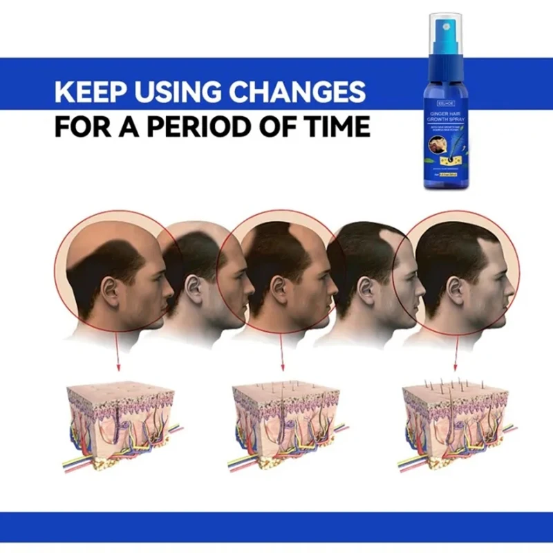 Hair Growth Spray Promote Fast - đánh giá và giá Perfume Zara